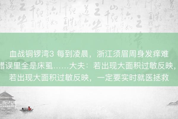 血战铜锣湾3 每到凌晨，浙江须眉周身发痒难耐，开灯一看，床板错误里全是床虱……大夫：若出现大面积过敏反映，一定要实时就医拯救